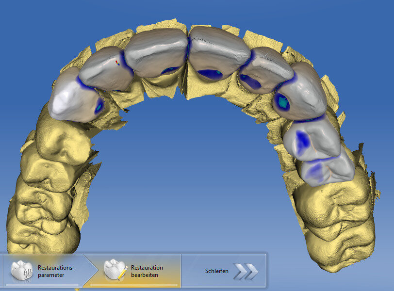 Fig. 8: Digital model