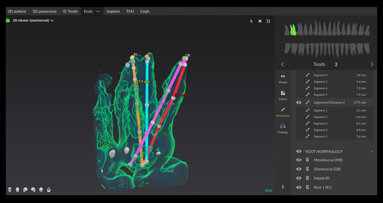Using digital software for effective root canal therapy
