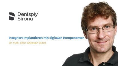Webinar teaser – Dentsply Sirona Implants – Integriert Implantieren mit digitalen Komponenten