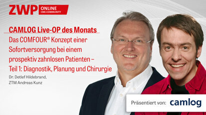 Live-OP: Das COMFOUR® Konzept – Teil 1 Live-OP: Das COMFOUR® Konzept – Teil 1