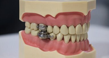 Debate por un dispositivo intraoral para perder peso