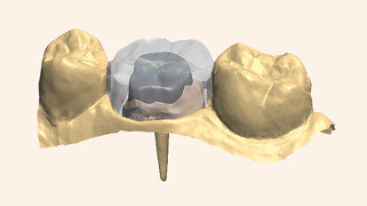 Solution de conception de pivots performante
