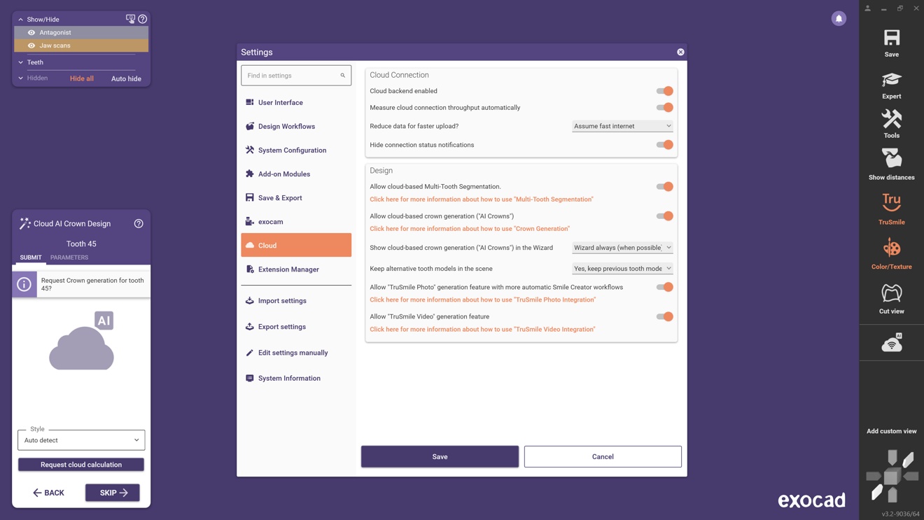 Fig. 4: DentalCAD settings allow enabling exocad Cloud features.