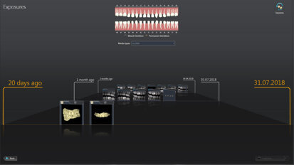 Meeting users’ needs: Dentsply Sirona releases Sidexis 4 V 4.3 and updates Orthophos SL