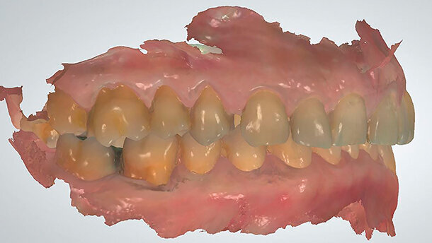 L’ortodonzia nell’era del digitale: il conflitto di meraviglie secondo Einstein