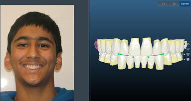 Ormco introduces digital suite, plans ‘debates’ at AAO meeting