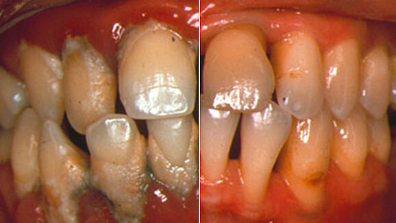 Where periodontology has advanced