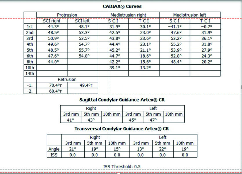 Fig. 4a : Les données du système CADIAX ont été transférées  dans l’articulateur virtuel.
