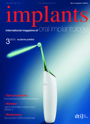 implants Poland No. 3, 2013 implants Poland No. 3, 2013