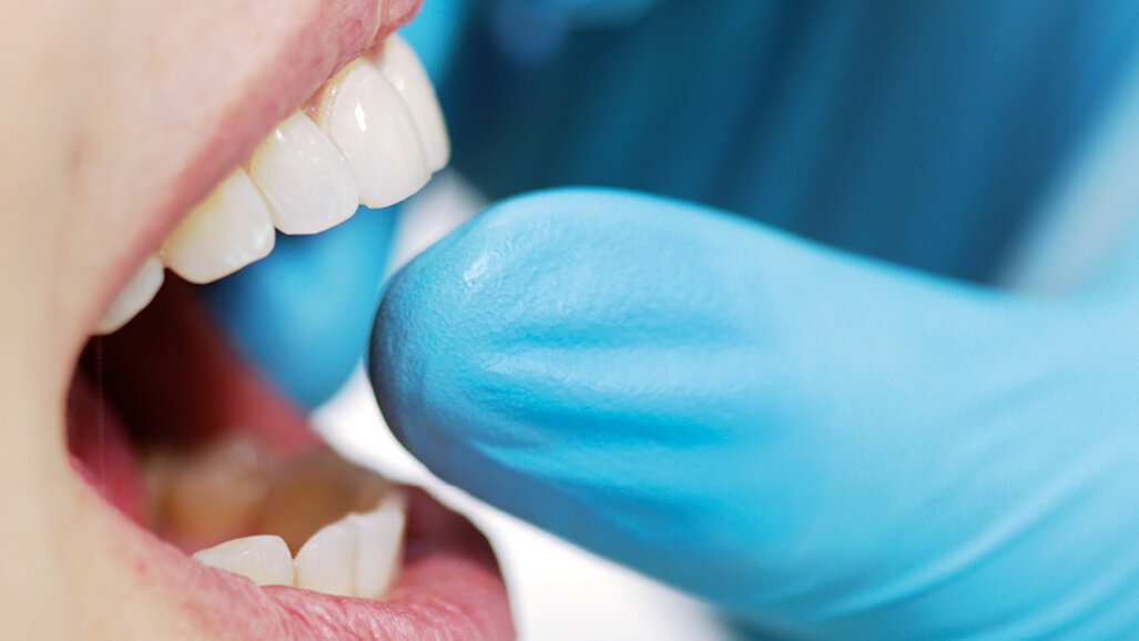 PANAVIA family: Three options, all general cementation needs covered