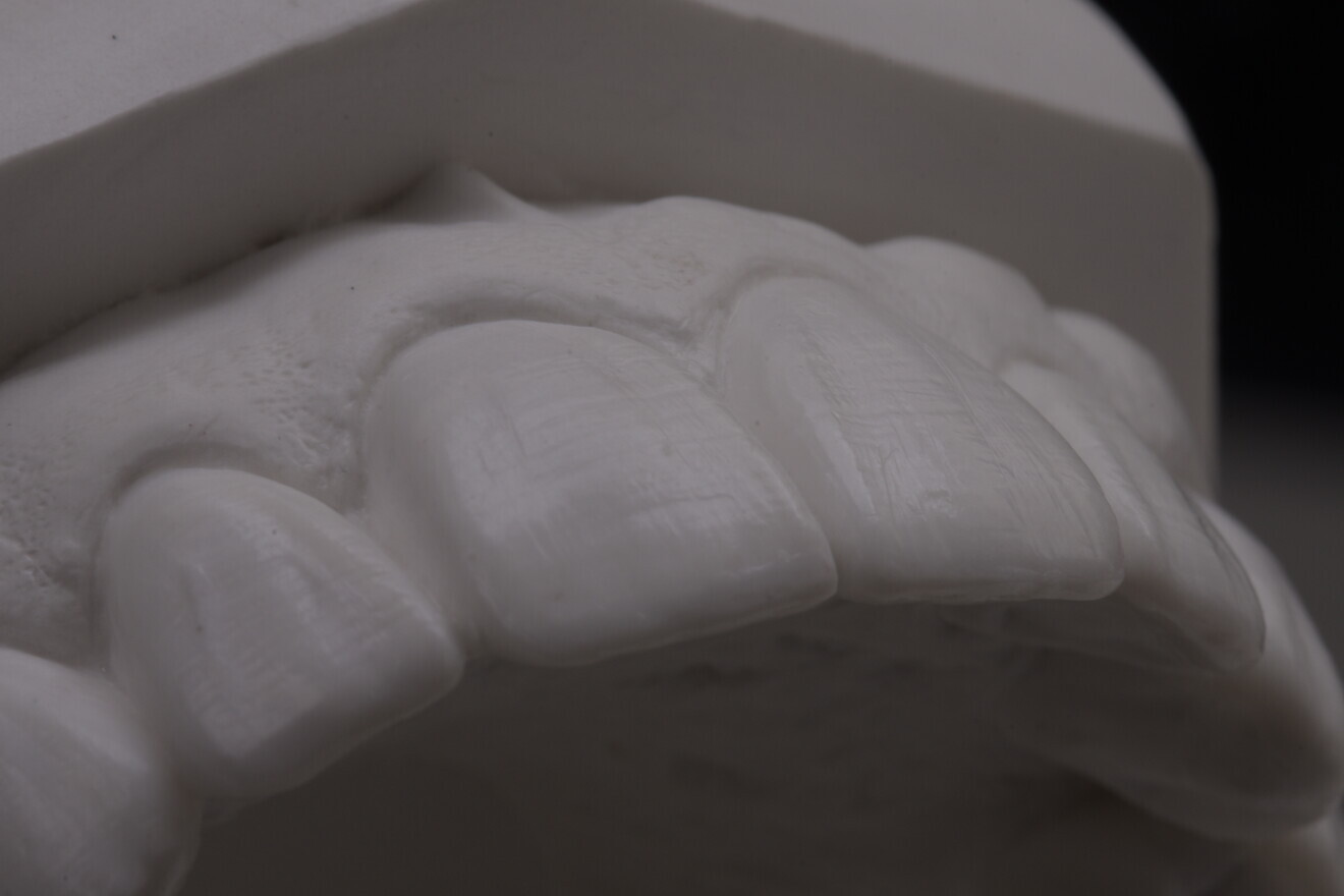 Fig. 3b: Diagnostic mock-up.