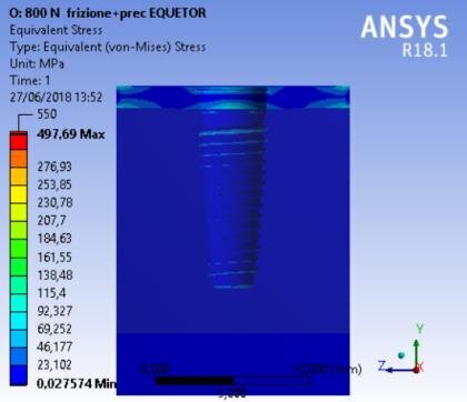Fig. 10c - Von Mises results referred to the bone at the maximum stress, OT Equator prosthesis.