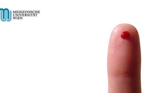 Allergien frühzeitig erkennen: Ein Blutstropfen genügt