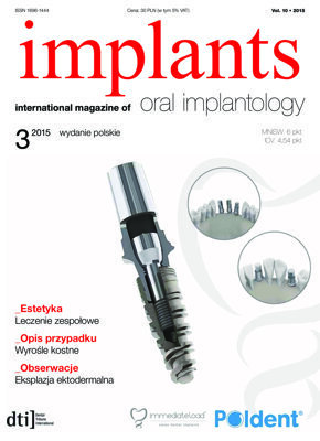 implants Poland No. 3, 2015 implants Poland No. 3, 2015