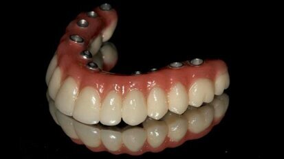 Leczenie implantoprotetyczne atroficznej żuchwy – opis przypadku