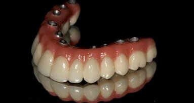 Leczenie implantoprotetyczne atroficznej żuchwy – opis przypadku