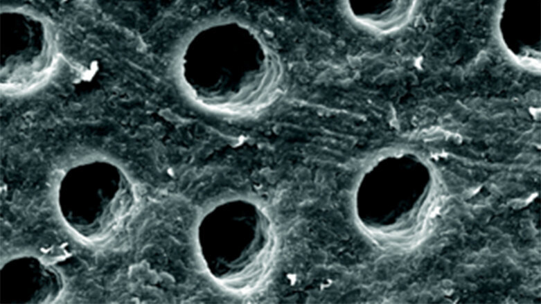 Zkušenosti s hypersenzitivitou dentinu při používání zubní pasty  s přidaným biosklem