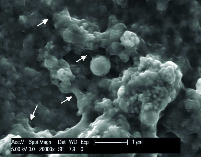 Fig. 10 d : Micrographies sous un grossissement de 20 000 fois montrant la présence de la pellicule sur les échantillons de titane (a) et d’email (c) servant de contrôle par rapport au titane rince avec HAP II (b) et a l’email rince avec HAP III (d). Deux heures après l’exposition buccale ont ces solutions, les images prises sous plus fort grossissement permettent d’observer les structures de connexion entre la solution de HAP II et la surface en titane (b) et entre la solution de HAP III et la surface de l’email (d). Les HAP sont en contact direct avec des structures globulaires de la pellicule exogène acquise. Les flèches indiquent les ponts 