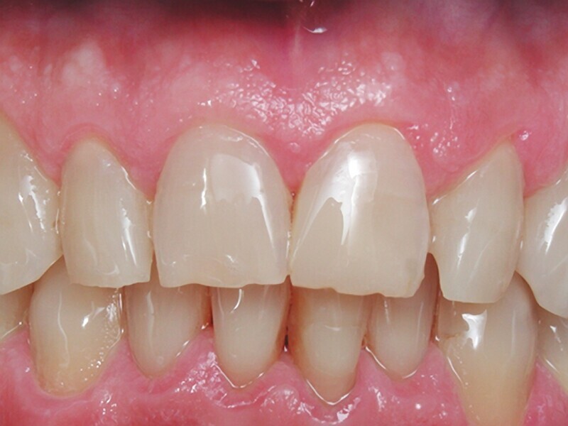 Figura 4. Caso terminado, imitando la naturaleza.