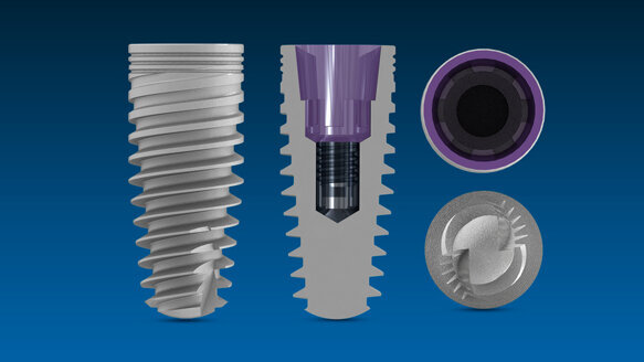 Mini-fellowship in implant dentistry to be offered at University of Miami