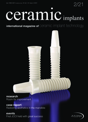 ceramic implants international No. 2, 2021 ceramic implants international No. 2, 2021
