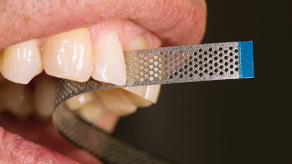 Tiras diamantadas para obturación y ortodoncia