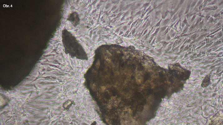 Afinita k zrnům tvrdé zubní tkáně je vidět na zrnu, které je obaleno buňkami. Předpokládáme, že toto zrno je dentin. Velké zrno v pravé části obrazu je bez buněčného obalu. Předpokládáme, že jde o sklovinu.