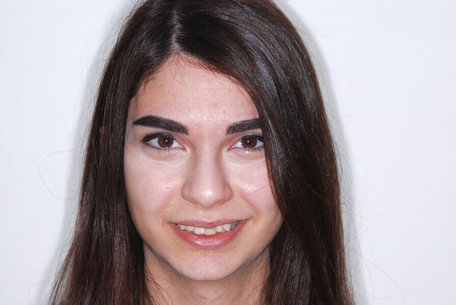 Fig. 13: Full-face frontal view before treatment.