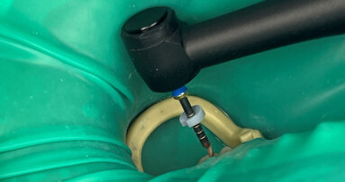 Practical tips for reliable endodontic treatment