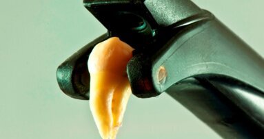 Laserowe obrazowanie i diagnostyka próchnicy w technologii NIDIFOTI