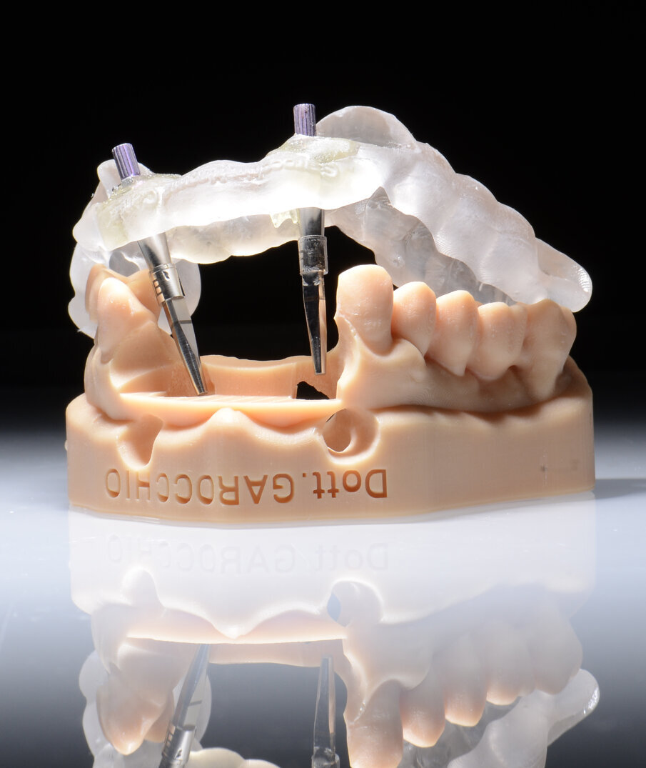 Fig. 38 - Riposizionamento sul modello master. 