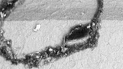 Is your dental implant system truly safe and clean?