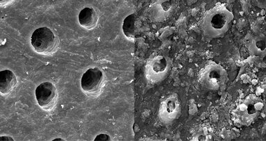 How dental sensitivity can be improved with BioMinF