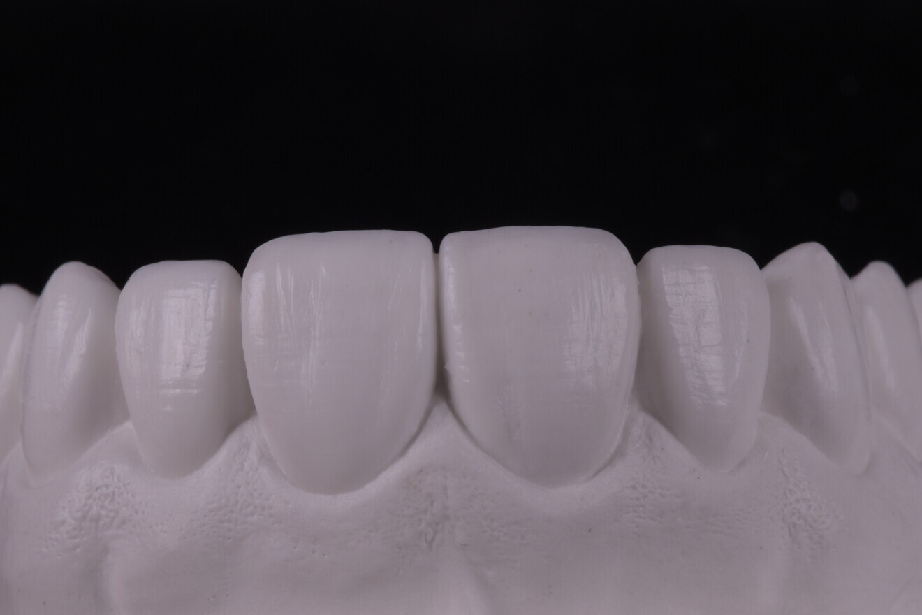 Fig. 3a: Diagnostic mock-up.