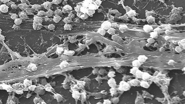 Beschermende coating vermindert aanhechting bacteriën