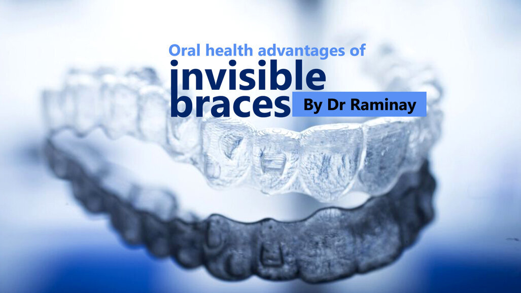 Oral health advantages of invisible braces
