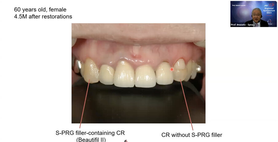 Lecture of Prof Satoshi Imazato, Japan