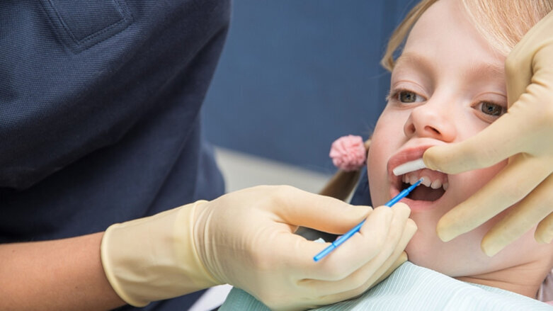 Lunos—An insider tip for hardening the tooth surface