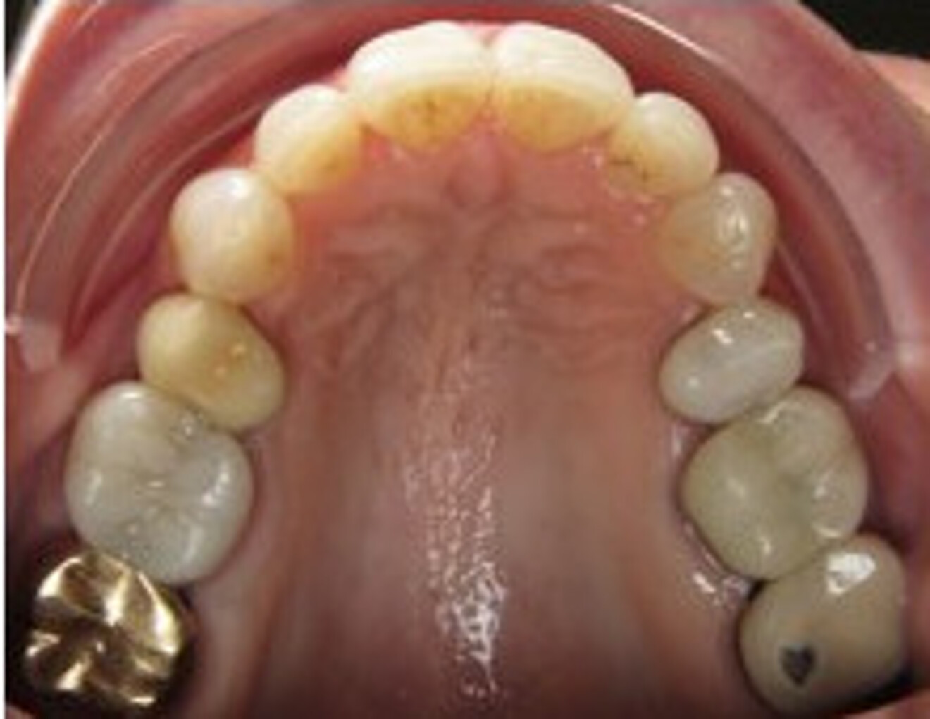 Fig. 9b: After. 