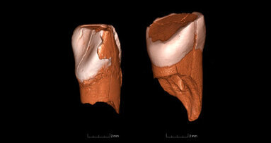 Prehistoric teeth connect modern humans with Neanderthal demise