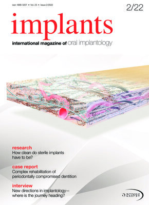 implants international No. 2, 2022 implants international No. 2, 2022
