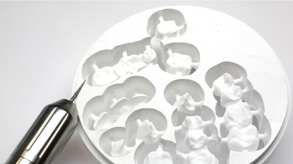 Digitale Technologie für passgenaue Prothetik