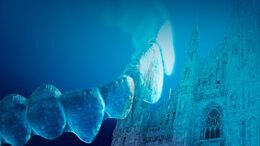 Challenges with aligners: Visioni differenti, strategie a confronto