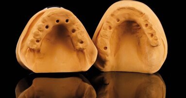 Réhabilitation occlusale transvissée maxillaire et mandibulaire sur bases en titane