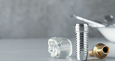 Three implant designs, one connection: Webinar offers tailored solutions for diverse clinical needs