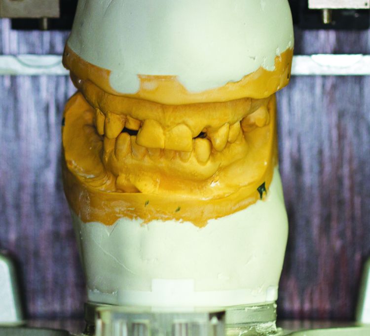 Fig. 4: Incorrect mounting