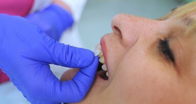 Alerta sobre el turismo dental en Marruecos