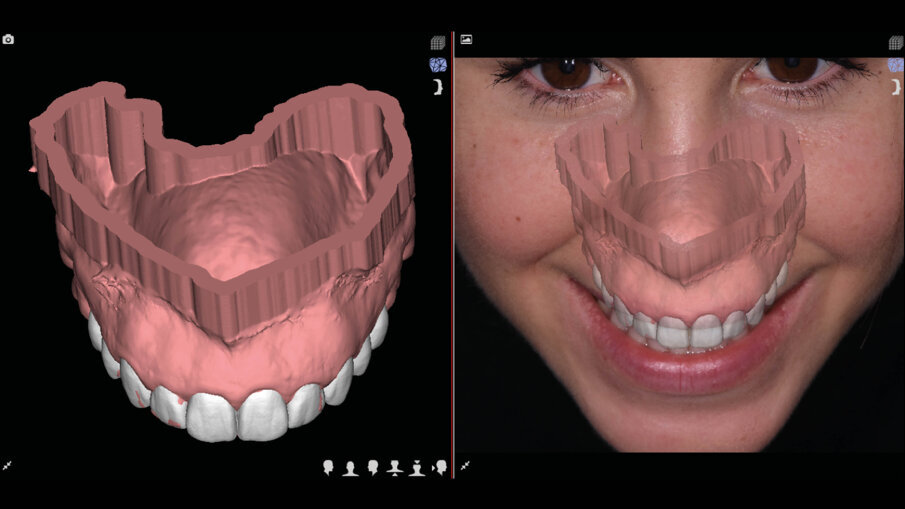 Figg. 5a-6b_Valutazione iniziale.