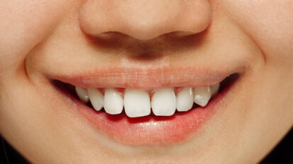 IX Międzynarodowa Konferencja Naukowo-Szkoleniowa Lekarzy Dentystów „Między funkcją a estetyką”