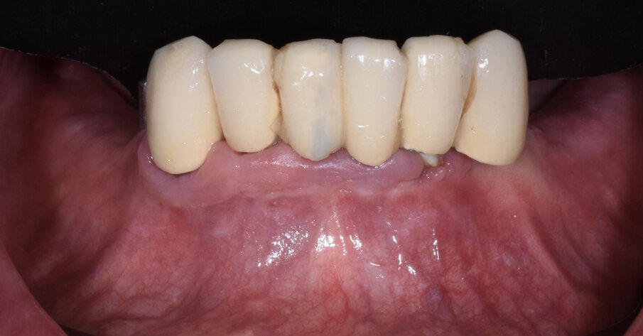 Fig. 2 - Situazione clinica iniziale.